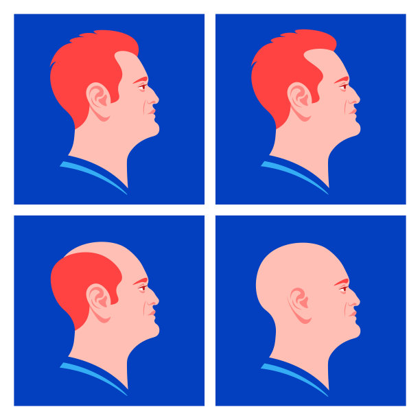 秃顶的阶段脱发。欧洲男人的简介。图片下载