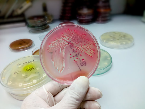 麦康凯琼脂(培养基平板)中细菌的菌落。培养皿中图片下载