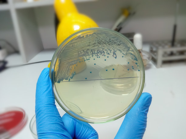 选择琼脂培养基，琼脂平板，封闭培养菌落。肠杆菌科。图片下载