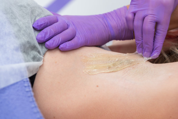 糖脱毛概念。在水疗沙龙用糖糊处理腋下女孩脱毛，白色背景。图片下载