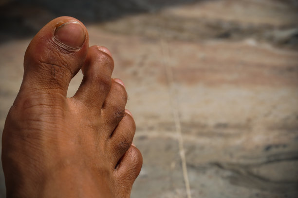 脚图像近距离拍摄图片下载