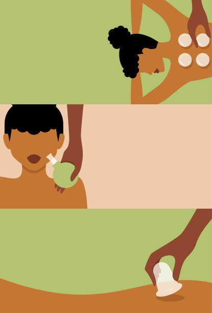 三个插图的妇女真空拔罐疗法|替代疗法插图图片下载