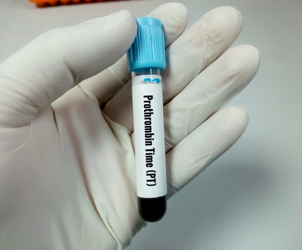 血凝酶原时间(PT)。凝血试验。医学或健康概念。PTT。图片下载