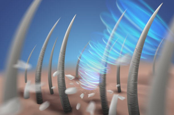 消除头皮上的头皮屑图片下载