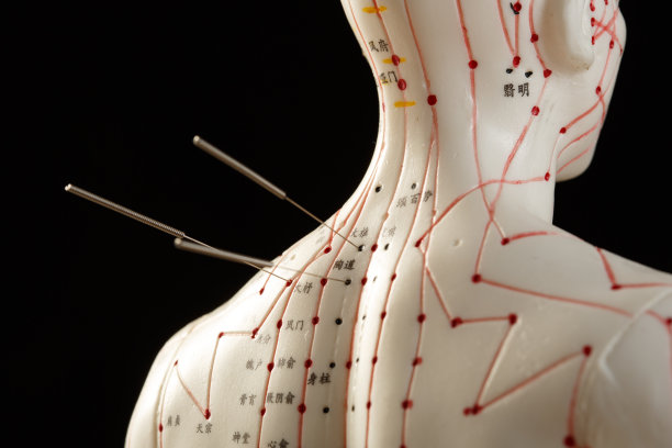 针灸穴位图片下载