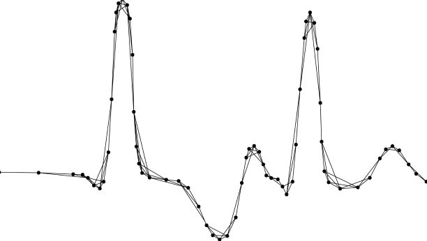 心电图提示窦状线错误图片下载