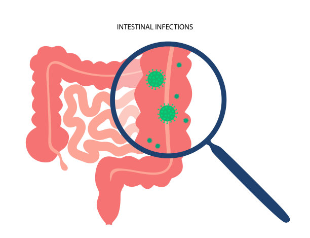 肠道感染疾病图片下载