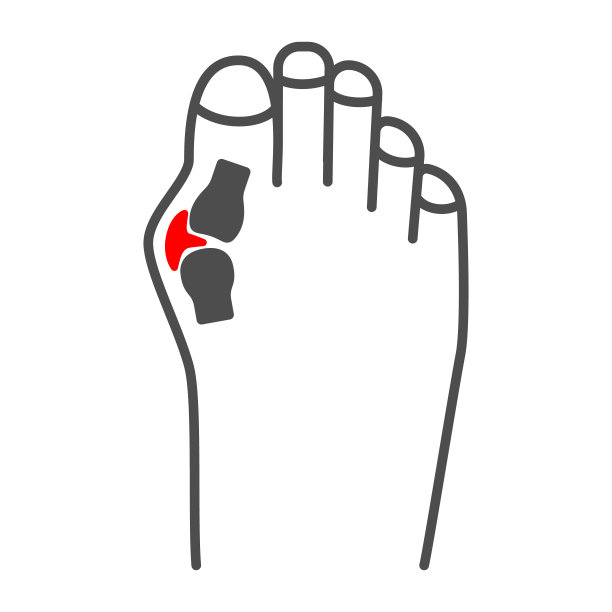 大脚趾关节疼痛细线图标，身体疼痛概念，拇囊炎矢量符号在白色背景上，轮廓风格图标为移动概念和网页设计。矢量图形。图片下载