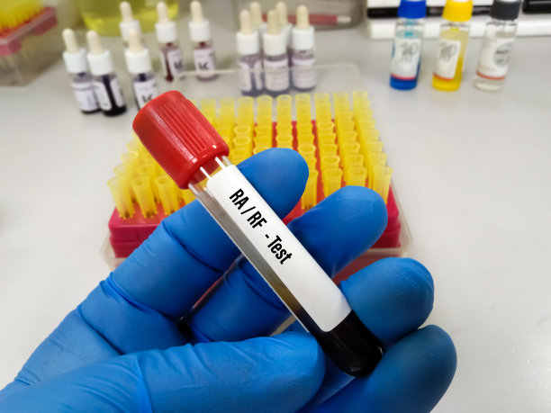 用于RA / RF检测的血液样管。图片下载