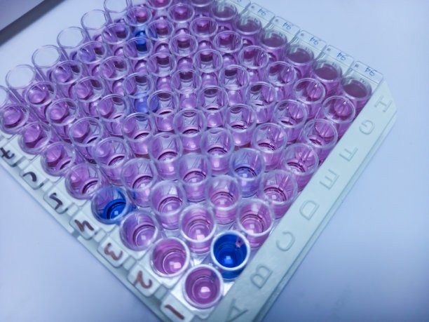 酶联免疫吸附试验(ELISA)板、医学实验室免疫或血清学检测方法、HIV检测、图片下载