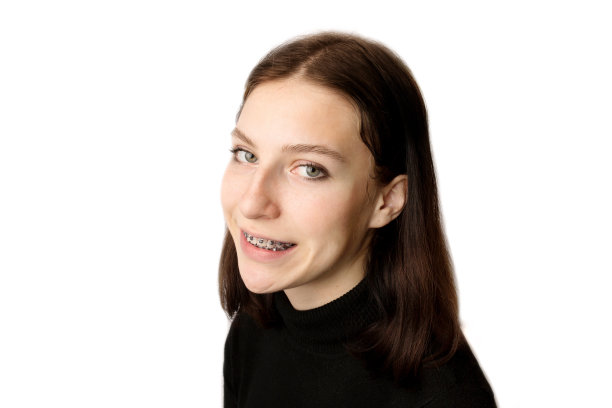 带着牙套微笑的少女。金属牙套紧贴牙齿。图片下载