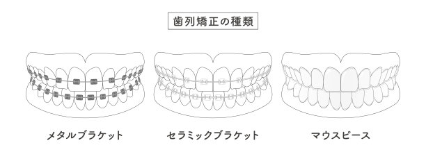 正畸型插图图片下载