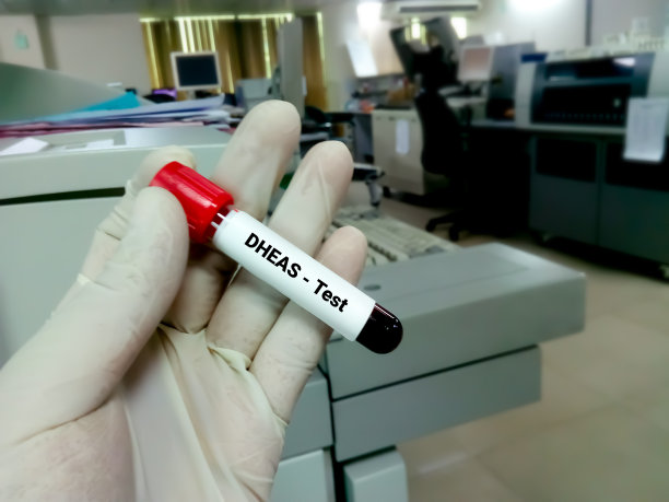 血液标本进行硫酸脱氢表雄酮激素试验图片下载