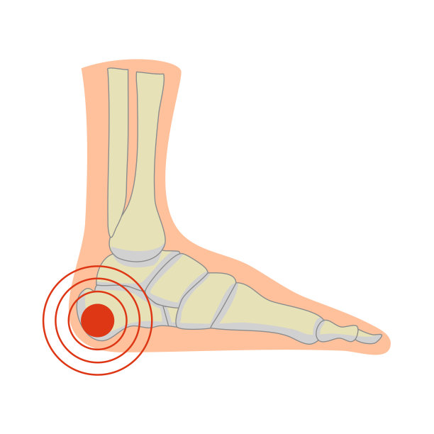 人类足骨解剖矢量插图的白色背景。在平底鞋中，男人或女人的脚跟和脚踝都会感到疼痛。图片下载