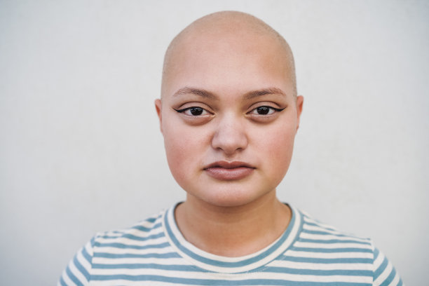 年轻的光头女孩在城市的室外看着相机-聚焦脸图片下载