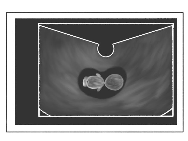胎儿的超声波扫描;怀孕12周图片下载