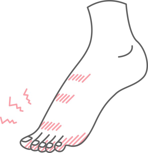 脚上冻疮的插图图片下载