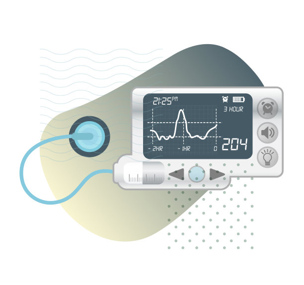 糖尿病胰岛素泵-库存说明图片下载