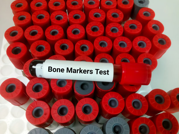 技术员手持血液样本进行骨钙素测试。骨标记图片下载