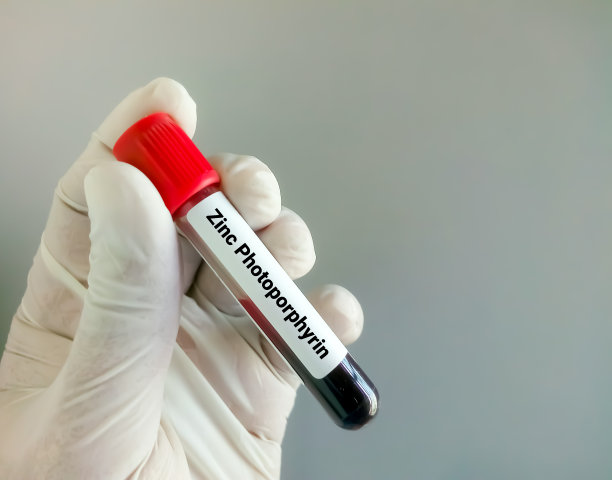 血液样本锌光卟啉(ZPP)试验诊断贫血症图片下载