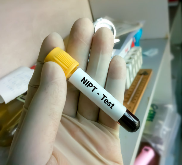 血液样本进行NIPT或无创产前检查，诊断妊娠期间胎儿唐氏综合征图片下载