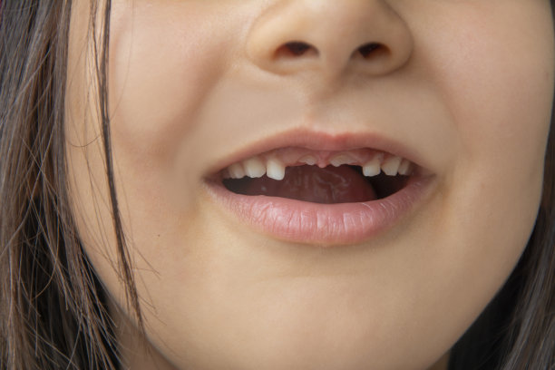 特写的小女孩有突出的门牙图片下载