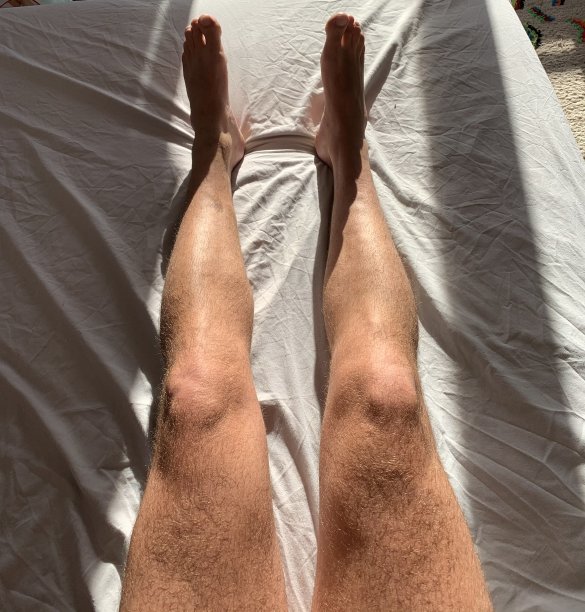 晒黑的双腿。图片下载