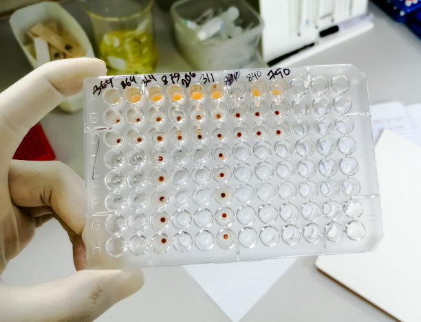 梅毒螺旋体抗体的血凝试验。TPHA。ELISA板、医学实验室血清学检测方法图片下载