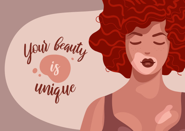 美丽的红发女子，白癜风在明亮的皮肤和波浪卷发。身体正面概念矢量插图。世界白癜风的一天。皮肤脱色疾病。海报，明信片，横幅。图片下载