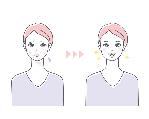 年轻女性皮肤护理色斑皮肤粗糙图片下载