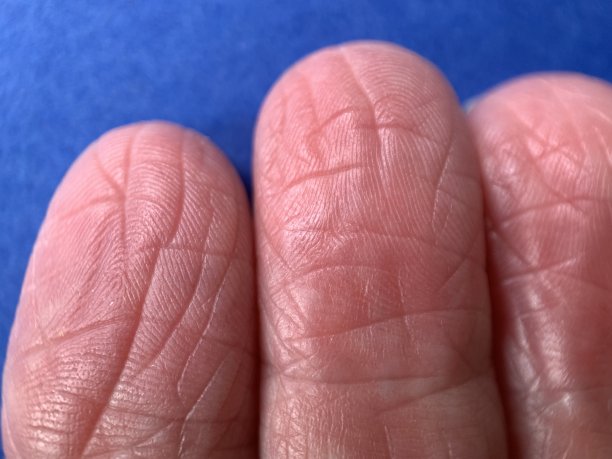 三个皱巴巴的手指靠近点图片下载