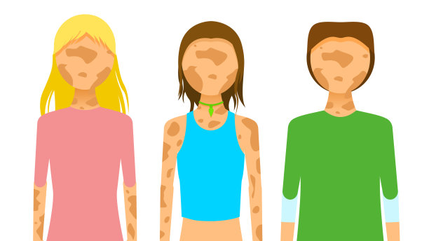 集平系列女孩女人男人性格色斑白癜风脱色病矢量设计风格概念人是平等的图片下载