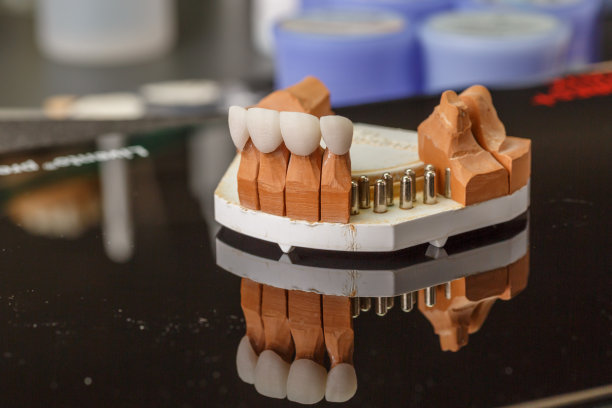 牙科植入物。恢复牙齿。牙科医生。牙科实验室。牙科诊所。人下颚的植入物。牙科诊所的视觉材料。口腔健康。图片下载