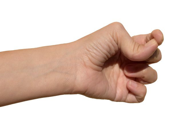 关节活动过度-手拇指活动过度图片下载