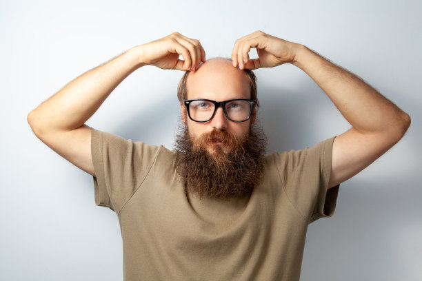 男的在摸他的头，哈?有头发问题，患有脱发，需要毛发专家咨询。图片下载