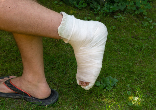 戴着白色石膏的断腿男子走在绿草地上。从楼梯上摔下来，摔断了腿。一条腿翘起来摔断了图片下载