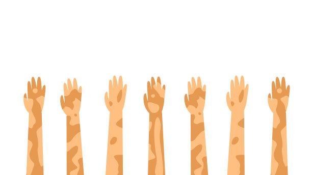 平手与斑点白癜风脱色病矢量设计风格概念人是平等的图片下载