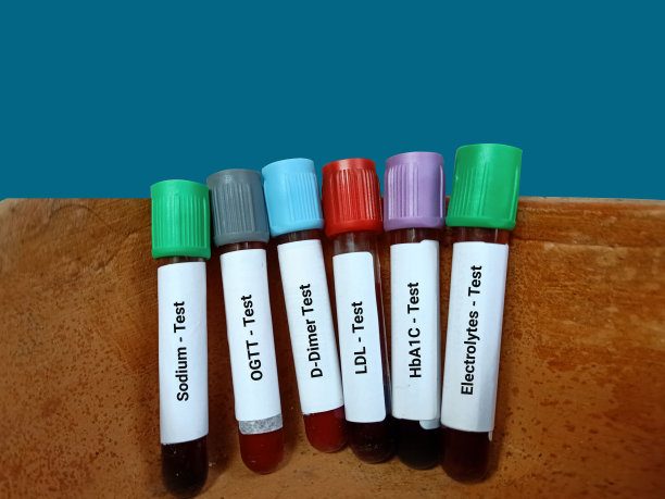 血液样本用于各种医学测试LDL, OGTT, HbA1C，电解质，钠和d -二聚体检测。医疗试管。图片下载