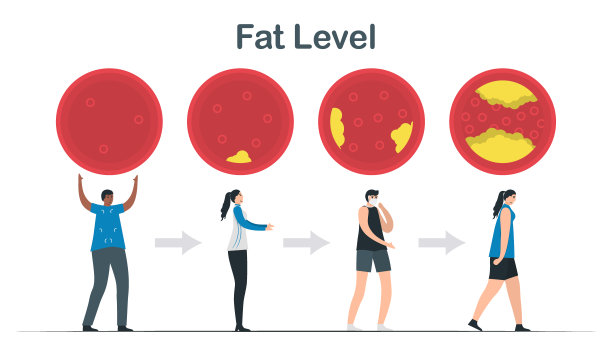 胆固醇水平。血管中的脂肪层强者变成弱者。在白色背景上分离的心脏病矢量插图。图片下载