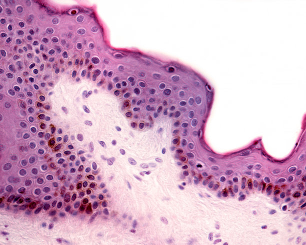 人类皮肤薄。黑色素颗粒图片下载