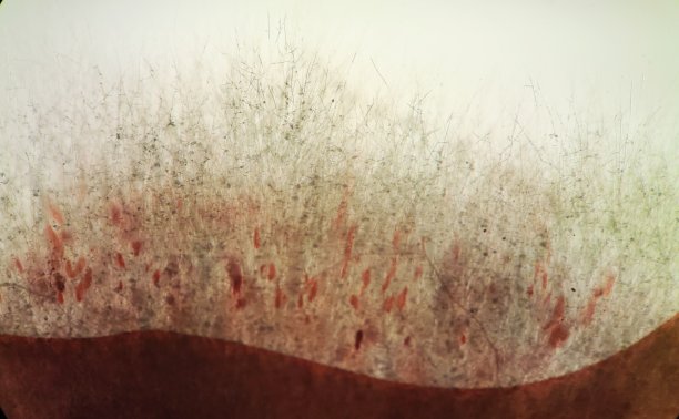 尖孢镰刀菌图片下载