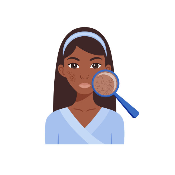 放大镜和皮肤干燥。孤立的美丽的黑人妇女与问题的皮肤在脸上。皮肤病。皮肤的治疗、诊断。平的卡通风格。插图的美丽，医疗设计。向量。图片下载