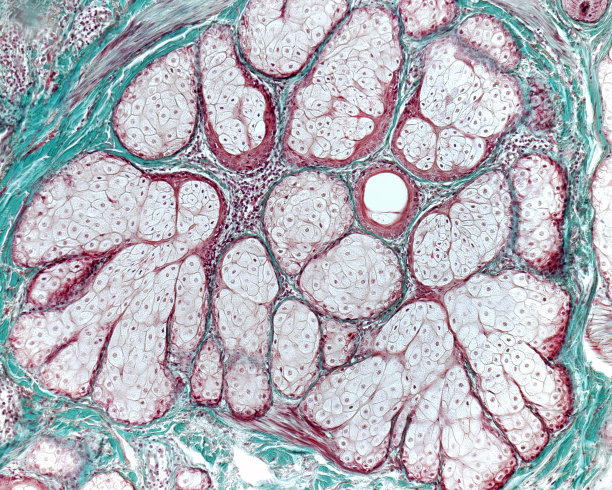 人类的皮肤。皮脂腺图片下载