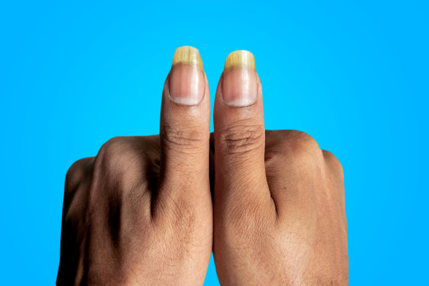 从俯视图可以看到男人的两个拇指指甲图片下载