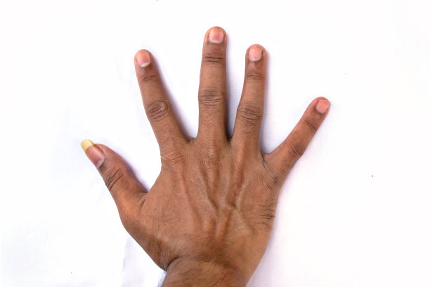 一个人在白色的背景上展示他又大又脏的指甲图片下载