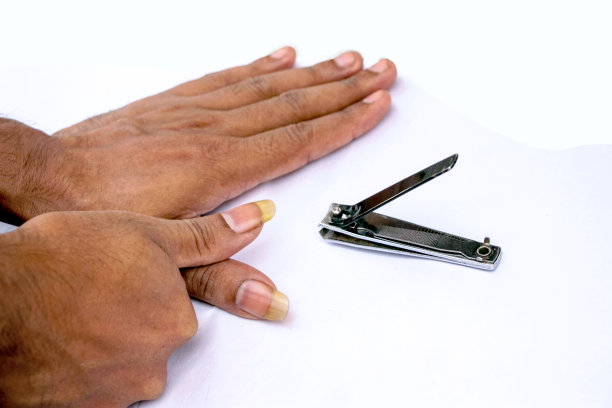 一个人在白色的背景上展示他又大又脏的指甲图片下载