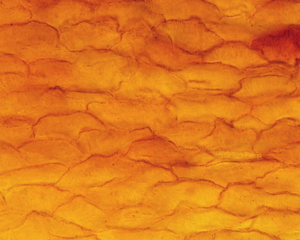 细胞间的限制。银染色图片下载