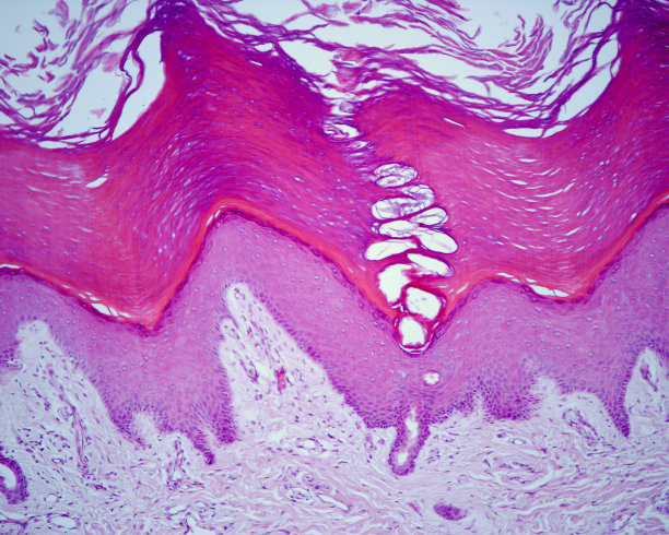 人的皮肤表皮较厚图片下载