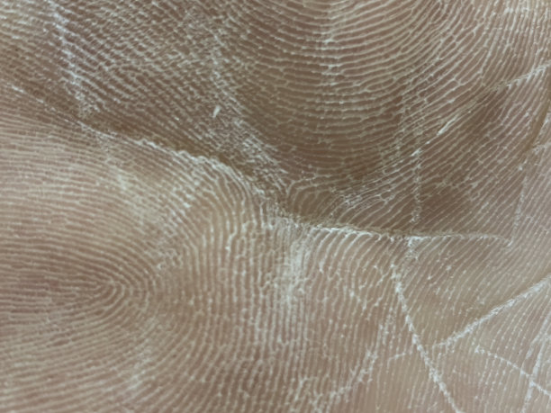 脚下的皮肤。图片下载