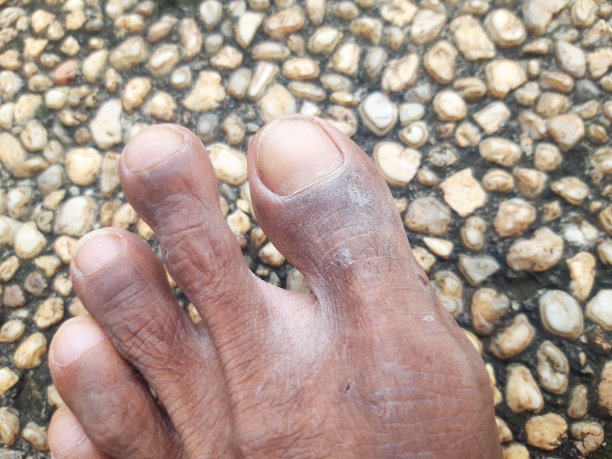 不健康的皮肤图片下载